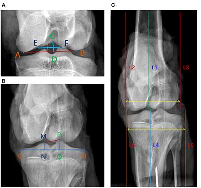 Comparison of the morphology of the anterior cruciate ligament and related bony structures between pigs and humans